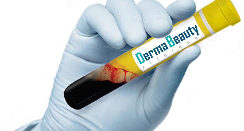 Tratament Plasma Proprie